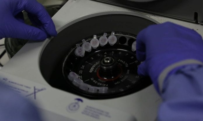 coronavirus_Exame